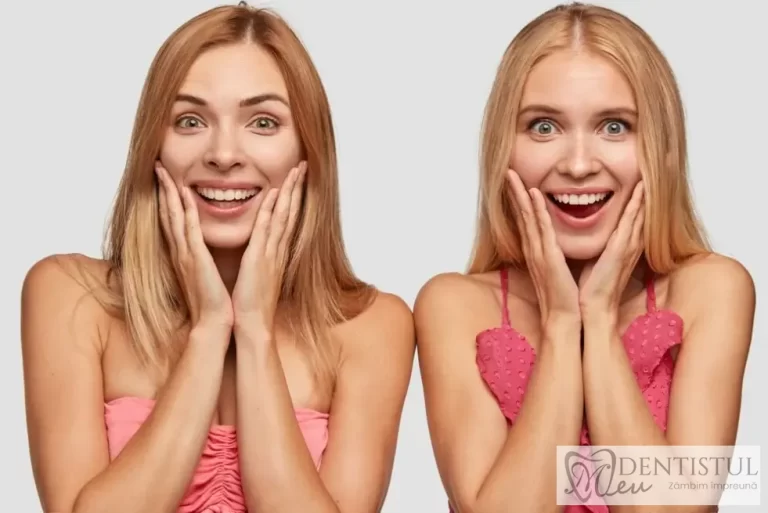 cancer-de-la-pasta-de-dinți